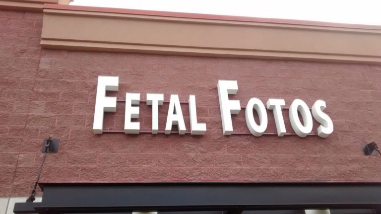 American Fork Fetal Fotos Review: 3D Baby Ultrasounds in Utah