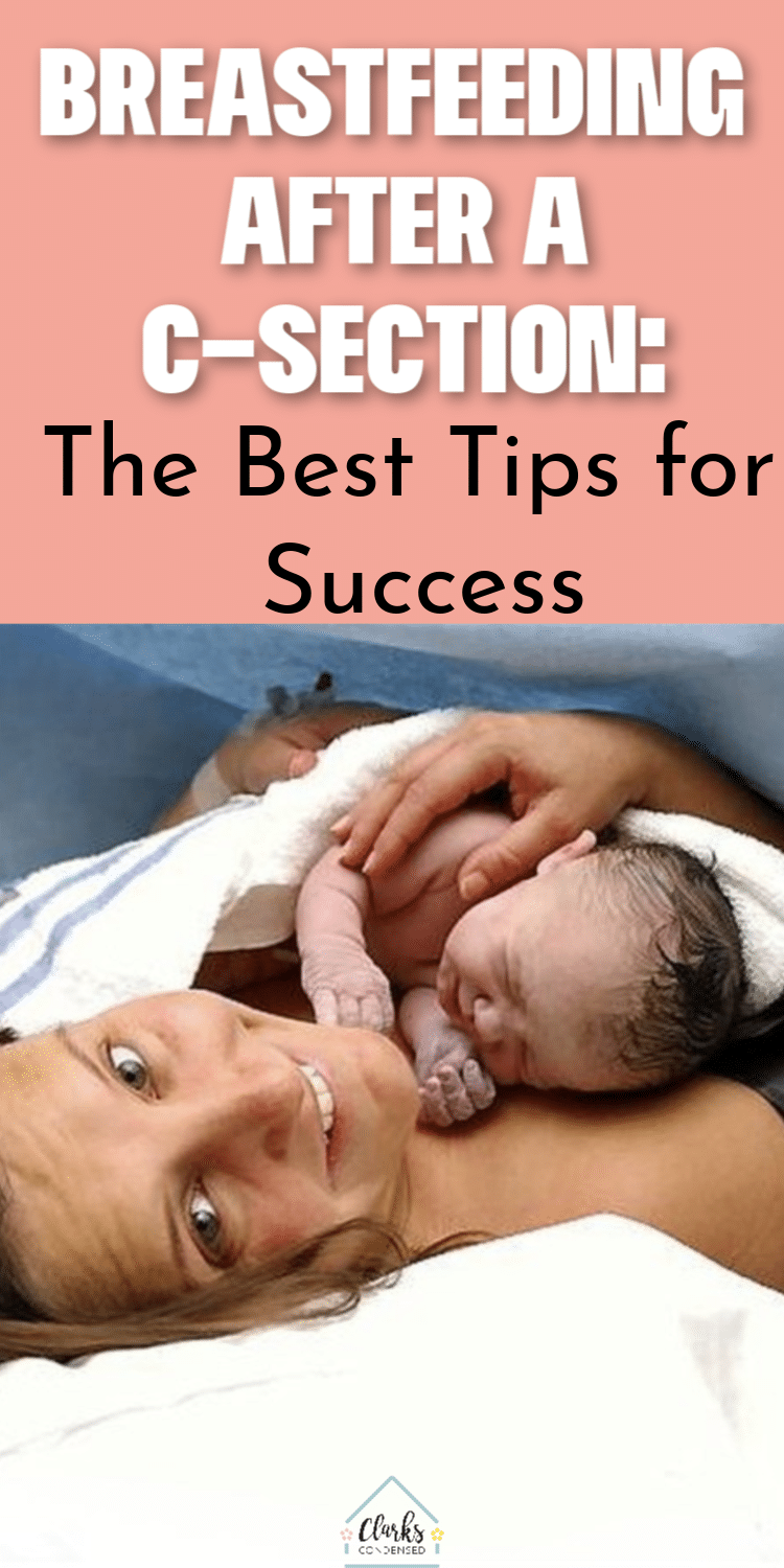 Breastfeeding After a Csection The Best Tips for Success Clarks